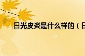 日光皮炎是什么样的（日光皮炎相关内容简介介绍）