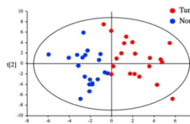 研究人员使用代谢组学发现肝细胞癌的潜在生物标志物