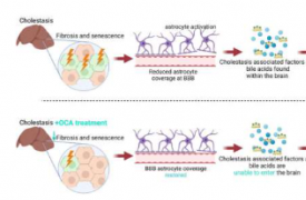 新研究发现有希望治疗与胆汁淤积性肝病相关的认知缺陷