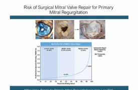 新数据阐明二尖瓣疾病患者的安全有效治疗