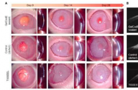 团队开发用于角膜组织重建的基于细胞外基质的粘性密封剂
