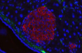 研究确定了与2型糖尿病相关的人类microRNA