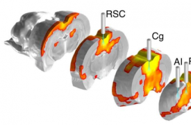 新型光学和 fMRI 平台可识别控制大规模大脑网络的大脑区域