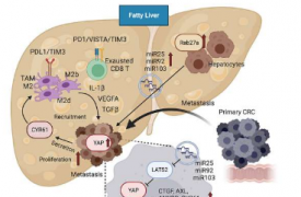 研究揭示脂肪肝如何促进结直肠癌扩散