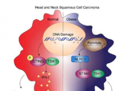 研究将肥胖与口腔癌的免疫检测减弱联系起来