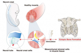 揭示异位骨的起源：来自神经嵴细胞研究的见解