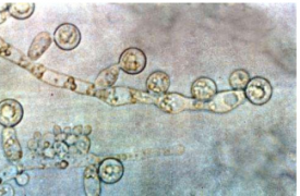 研究人员发现控制食欲的肠道激素可兼作真菌微生物组的免疫调节剂