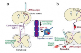 关于肌萎缩侧索硬化症中蛋白质介导的运动神经元丢失的新见解
