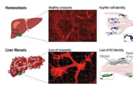 肝纤维化：巨细胞介入以补偿受损的免疫功能