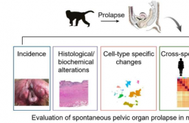 作为人类研究模型的非人灵长类自发性盆腔器官脱垂的综合评估