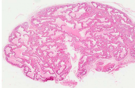 科学家发现可能导致男性生殖疾病的微生物组